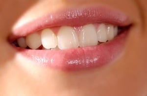 Cosmetic Dentistry