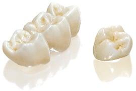 Dental Crowns