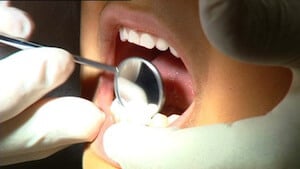 Dental Cleanings